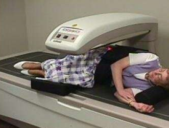 DXA Dilemmas: Important Things to Know About Bone Density Screening