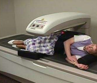 DXA Dilemmas: Important Things to Know About Bone Density Screening
